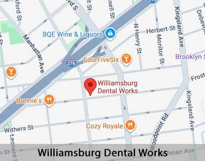 Map image for Dental Implants in Brooklyn, NY