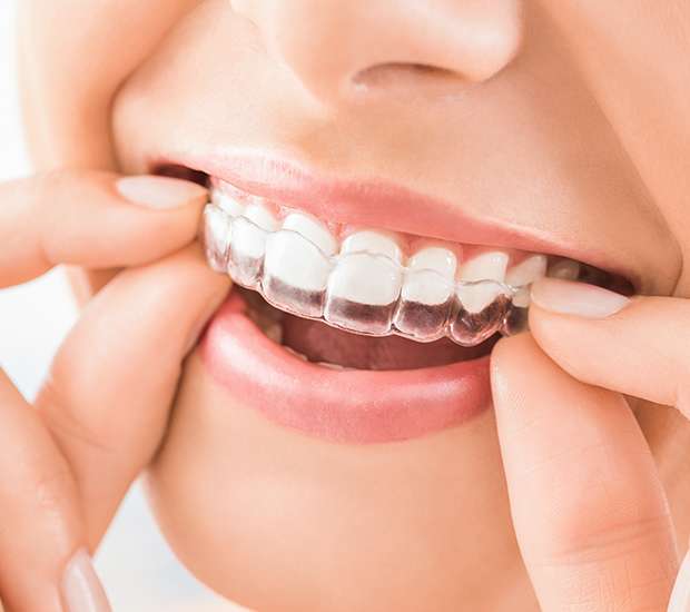 Brooklyn Does Invisalign Really Work